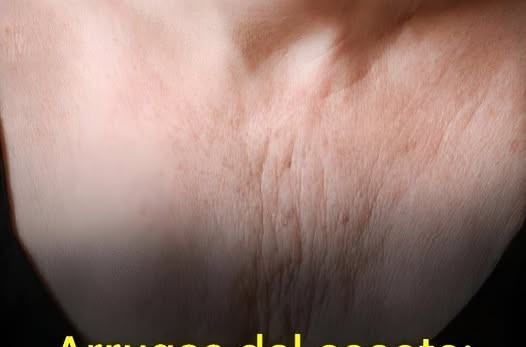 Décolletage wrinkles: 5 tips to prevent and eliminate them… See more.