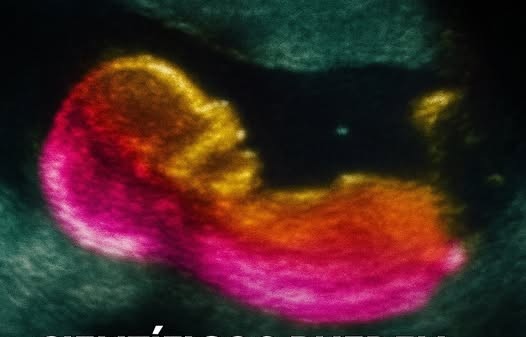 “Scientists may have discovered one of the causes of autism.”