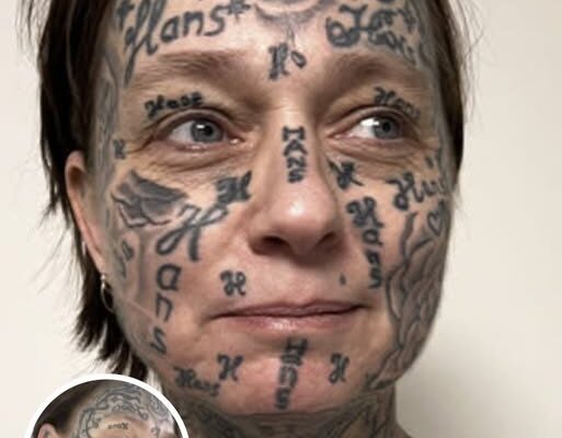 Woman Removes Tattoos of Her Ex’s Name and Shares Her Transformation Journey