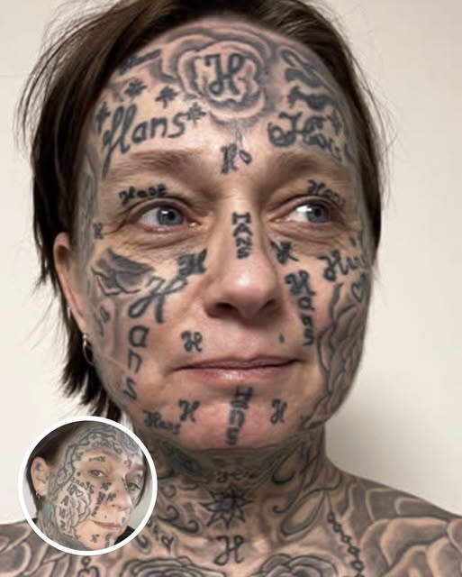 Woman Removes Tattoos of Her Ex’s Name and Shares Her Transformation Journey