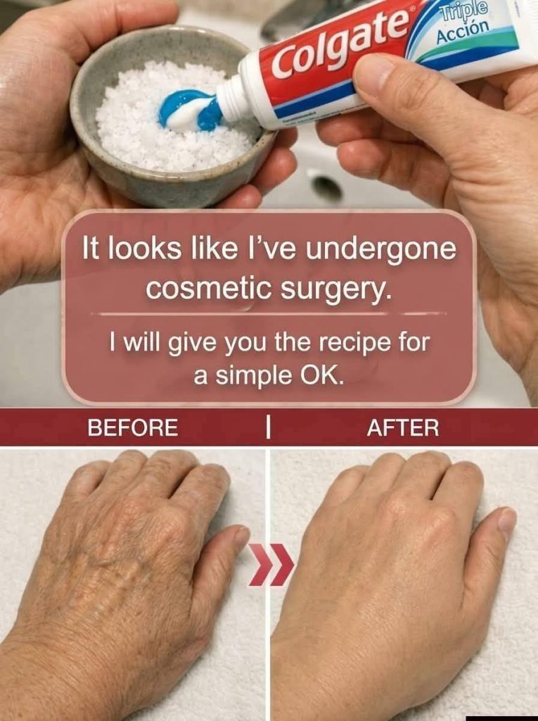 How Toothpaste Can Improve the Appearance of Age Spots and Wrinkles Naturally