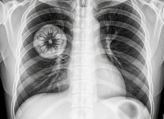 Warning: People vaccinated against COVID-19 could…See more