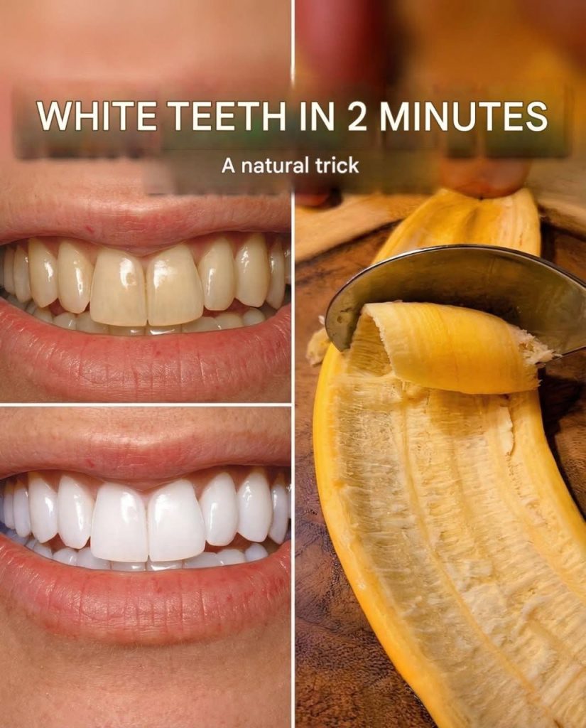 Secret Dentists They Don’t Want You to Meet: Removes Tartar and Whitens Teeth in Just 2 Minutes