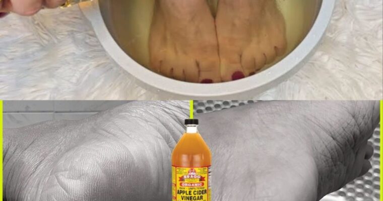 I soaked my feet in APPLE CIDER VINEGAR and 15 minutes later I was shocked at what happened !