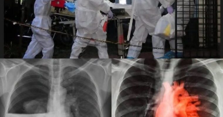 COVID-19 vaccinated individuals may be ill…See more