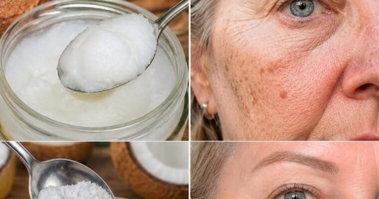 Homemade Baking Soda Cream Triggers the Skin Barrier Collapse Behind Dark Spots