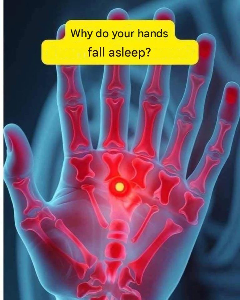 If your hands fall asleep, it’s a clear sign that you have cancer…See more