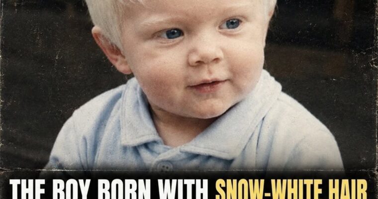 The Boy Born With Snow-White Hair – His Life Today