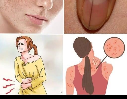 10 Cancer Warning Signs Women Often Overlook