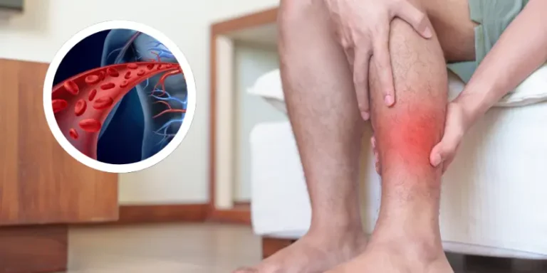 One vitamin that opens blood vessels and improves circulation