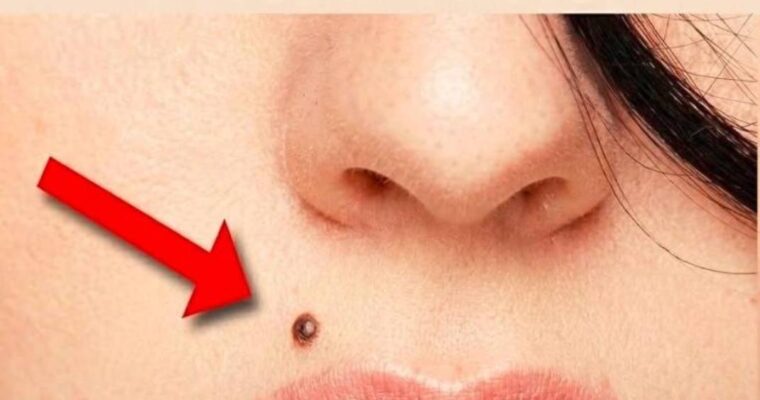 If you have a mole in one of these 7 spots on your body, this is what it means. You’ll be surprised!