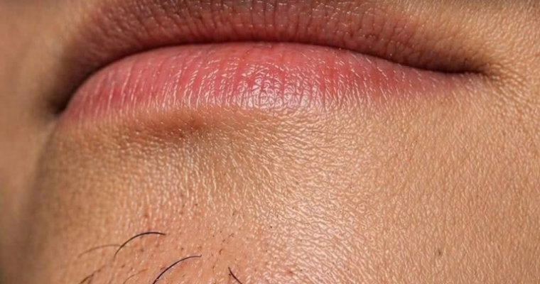 A Woman’s Chin Hair Could Be a Sign of More Than Just Aging, Experts Say